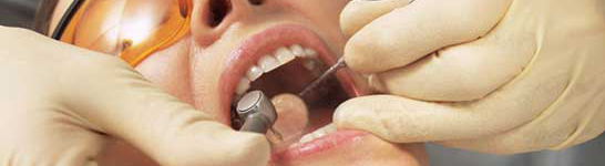 Dental procedures